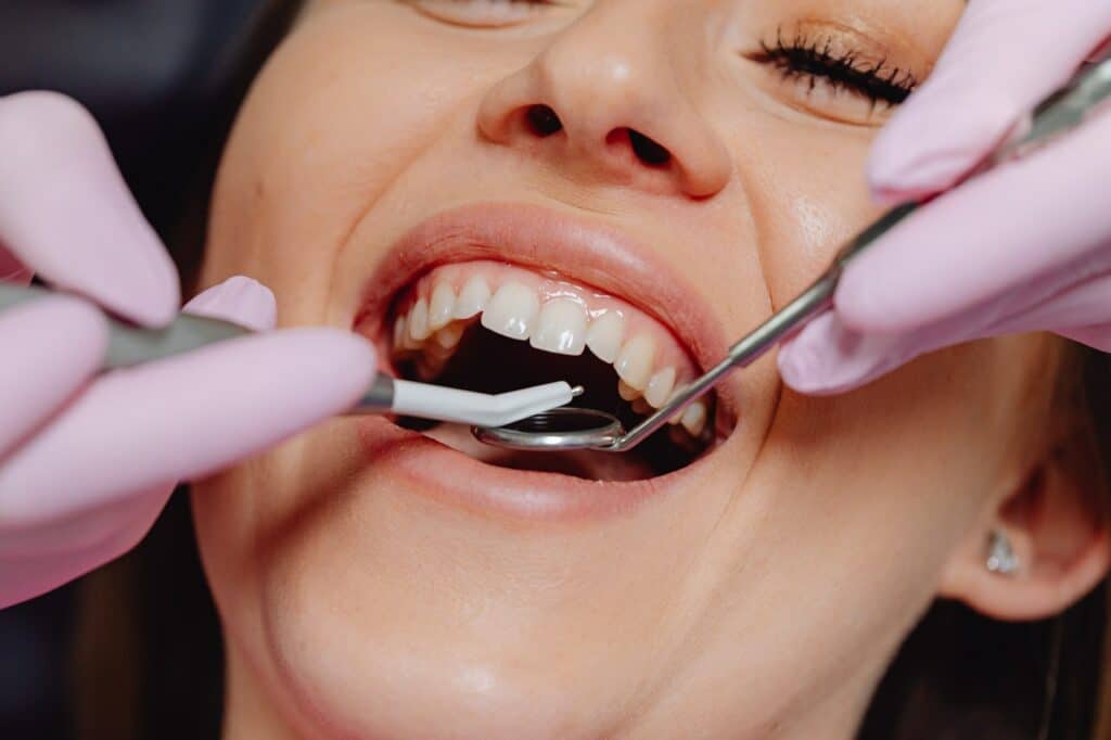 Estética dental en Institut Odontològic Bonanova